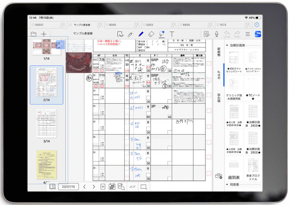 iPad